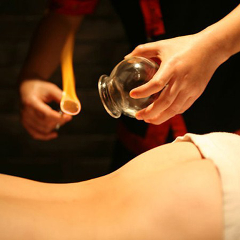 中奇仁和中醫養生-拔罐