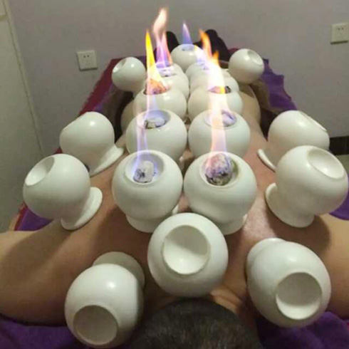 玉施蓮汗蒸養生館火罐